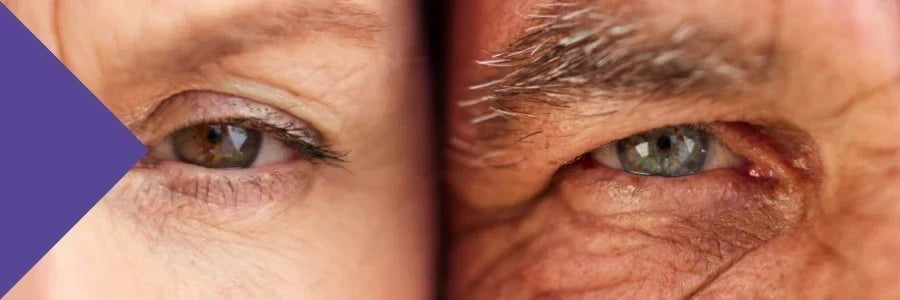 reduce wrinkles naturally